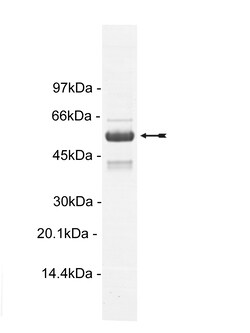 Eurofins DiscoverX PRAK Protein, Active 15 &mu;g | Buy Online | Eurofins DiscoverX | Fisher Scientific